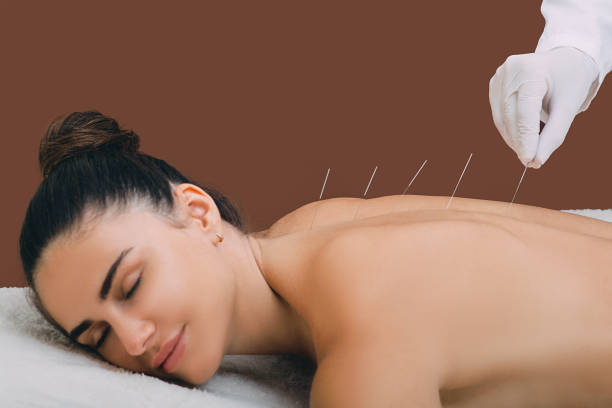 mujer recibiendo una terapia de acupuntura en Zaragoza